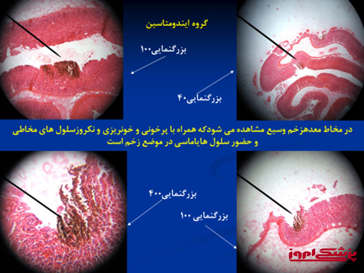 ایندومتاسین