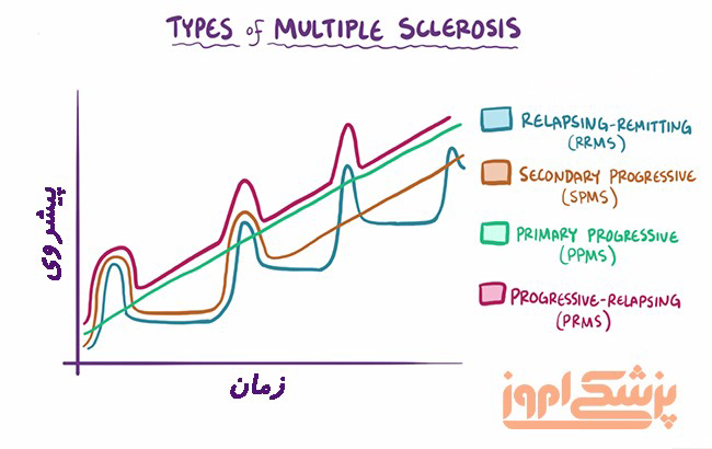 انواع مختلف بیماری ام اس