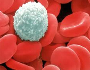 کاهش گلبولهای سفید درفرآورده‌های سلولی خون