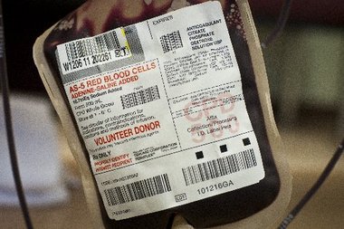 انتقال خون و MI