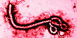 بیماری ویروسی ابولا