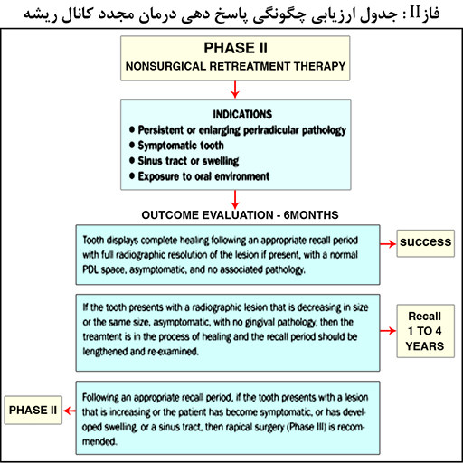 مراحل درمانی کانال ریشه