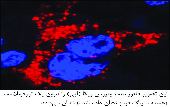 آلودگی جنین به ویروس زیکا