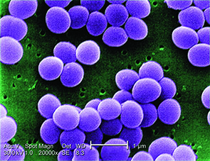 افزایش عفونت‌های مقاوم به آنتی‌بیوتیک