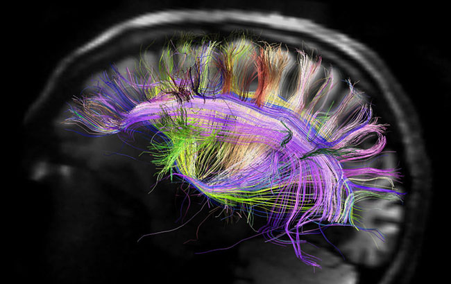 تصویربرداری مغز در روانپزشکی
