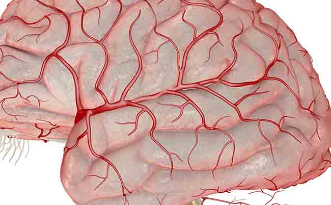 در سکته مغزی، سلول‌های مغزی تخلیه‌های الکتریکی مخرّب را تشدید می‌کنند