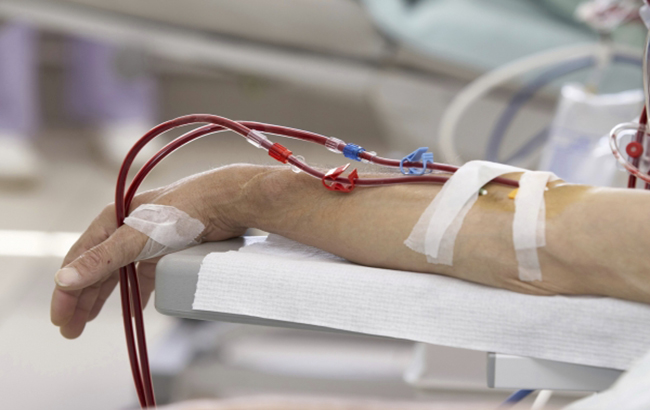 مرگ زودرس ناشی‌از لخته‌شدن خون در بیماران کلیوی