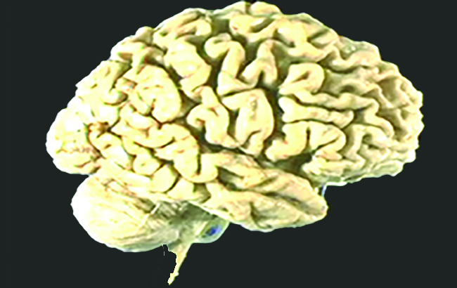 پیشگیری‌از آتروفی مغزی با رژیم‌غذایی مدیترانه‌ای