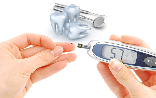 تأثیرات بیماری‌های پریودنتال بر نتایج بیماری دیابت