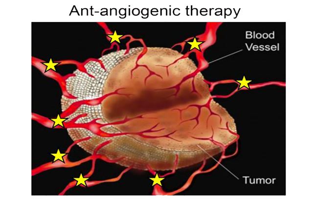  واکنش تومور به درمان ضد‌ رگ‌سازی (آنتی‌آنژیوژنیک)
