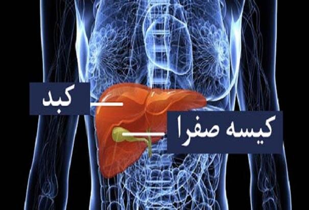 با علائم سنگ کیسه صفرا آشنا شوید