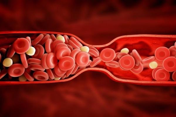 تستوسترون درمانی احتمال لختگی خون در مردان را افزایش می دهد