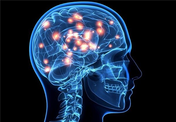 سکته مغزی قابل درمان است/ زالو درمانی برای سکته مغزی خطرناک است