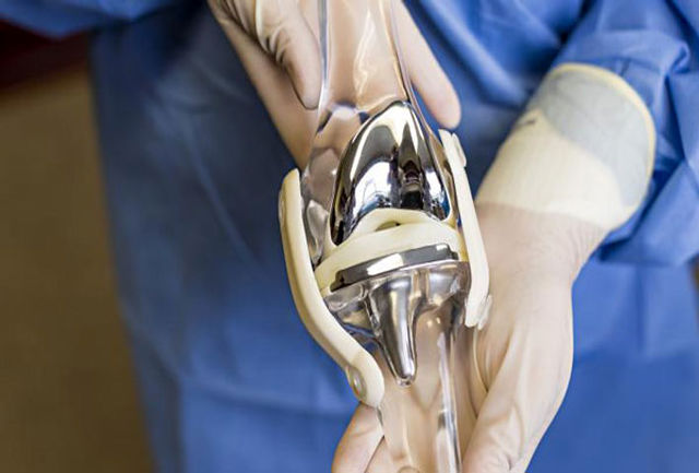 تصویب جدیدترین گایدلاین درمانی تعویض مفصل در کشور