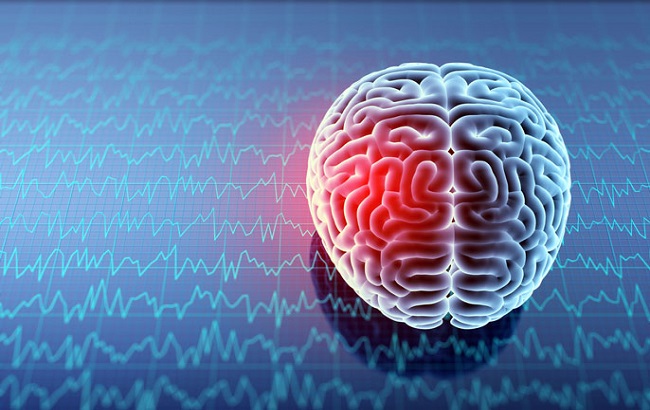 برپایی کارگاه نقش تحریک الکتریکی مغز در توانبخشی بیماران مبتلا به سکته مغزی
