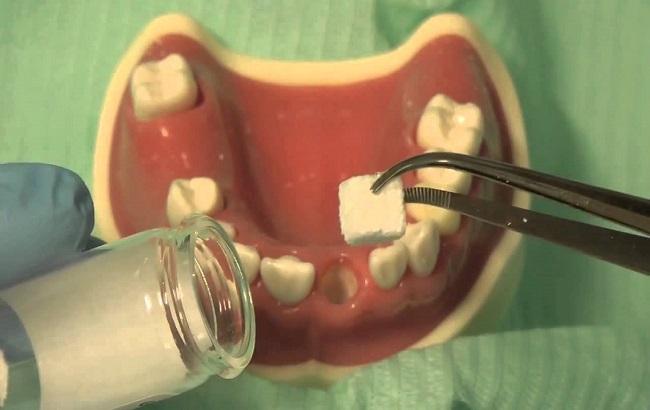 مروری بر خواص کلاژن و کاربرد آن در دندانپزشکی
