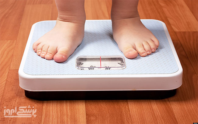 چاقی کودکان و خطر بیماری ام اس