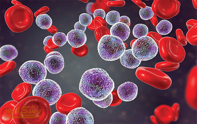 درمان خط مقدم CLL درسال ۲۰۱۸