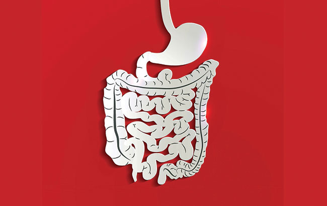 علائم ، دلایل، عوارض ، تشخیص ، پیشگیری و درمان سرطان کولون (سرطان روده بزرگ)