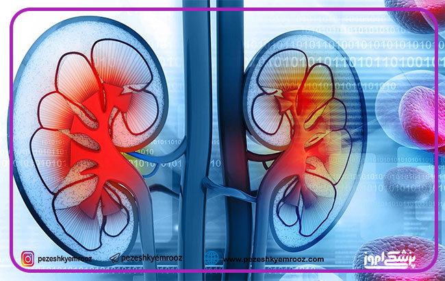 درمان بیماری‌های کلیوی و مجاری ادراری با رویکرد سلول درمانی