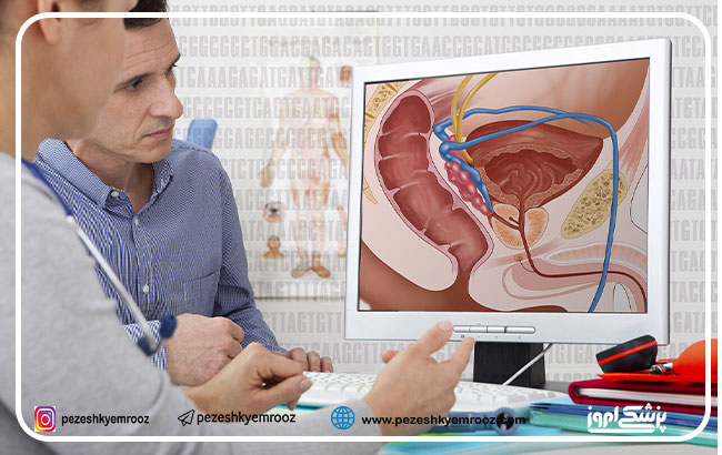 بیوپسی MRI هدفمند ، سیستماتیک و ترکیبی برای تشخیص سرطان  پروستات