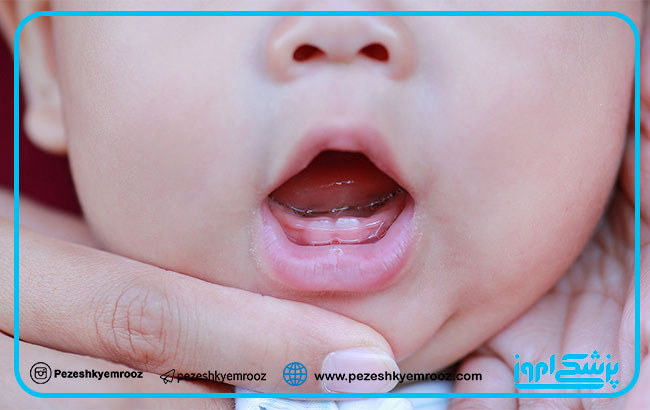 اهمیت و حفظ دندان‌های شیری در کودکان