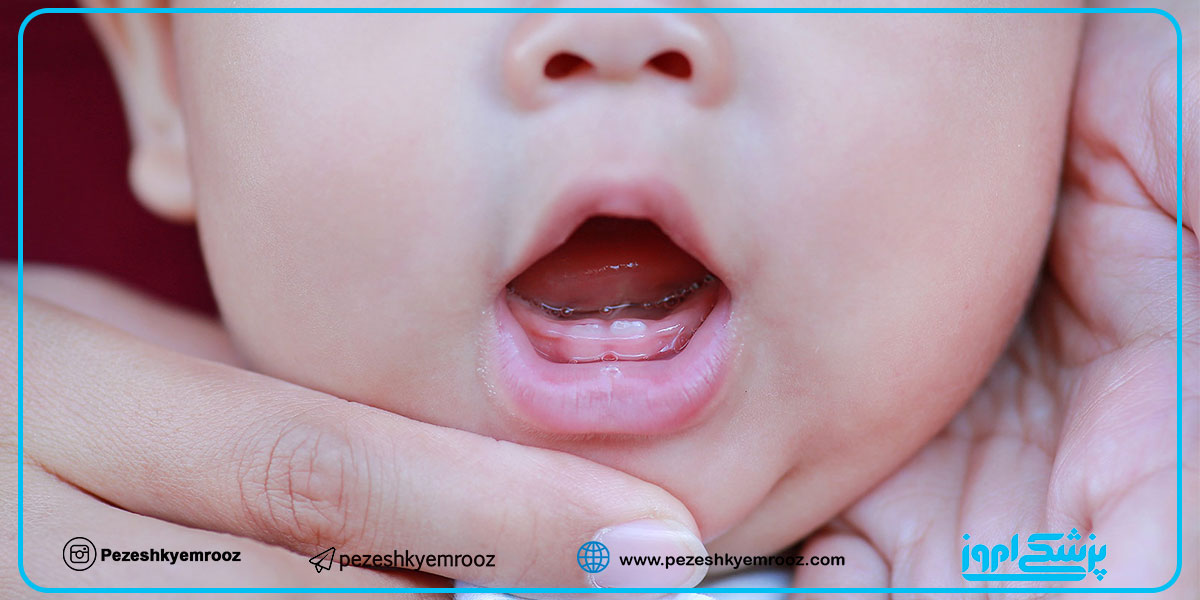 اولین ویزیت دندانپزشکی کودک باید پس از رویش نخستین دندان و حداکثر تا یک‌سالگی کودک انجام شود. در ویزیت دندانپزشکی در سنین پایین علاوه بر بررسی وجود یا عدم وجود حفرات پوسیدگی و سایر مشکلات، دندانپزشک می‌تواند به والدین نشان دهد که چگونه دندان‌های کودک را به درستی تمیز نمایند و چگونه عاداتی مانند مکیدن انگشت شست را کنترل کنند.

